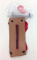 Afr/Amer Laceration Of Forearm
