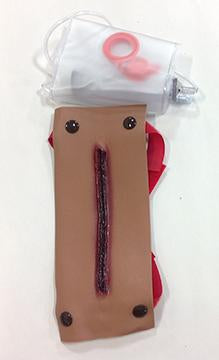 Afr/Amer Laceration Of Forearm