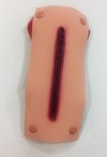 Lacerated Forearm